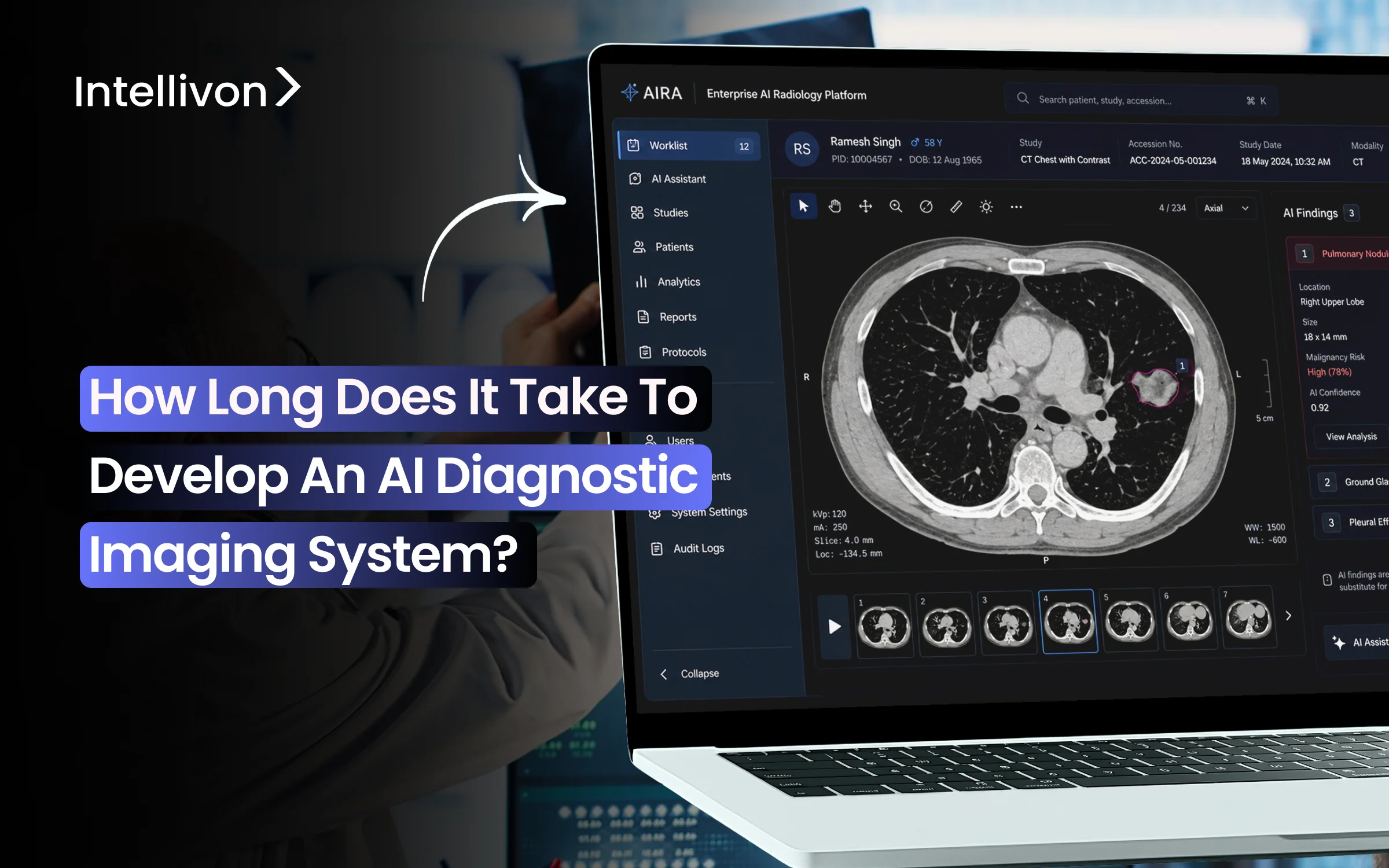 How Long Does It Take To Develop An AI Diagnostic Imaging System