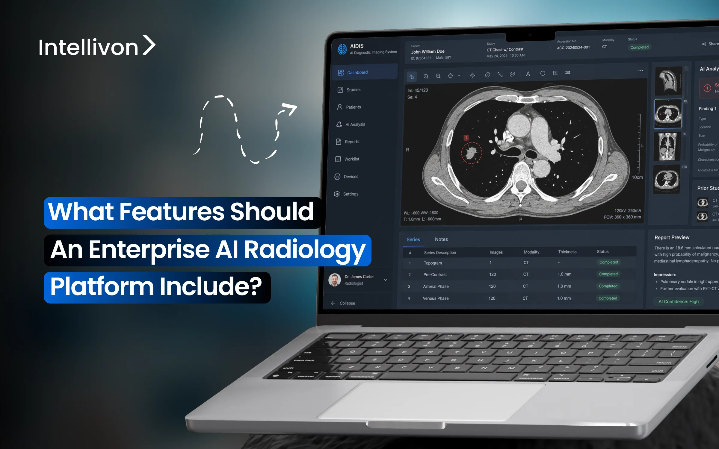 What Features Should An Enterprise AI Radiology Platform Include_
