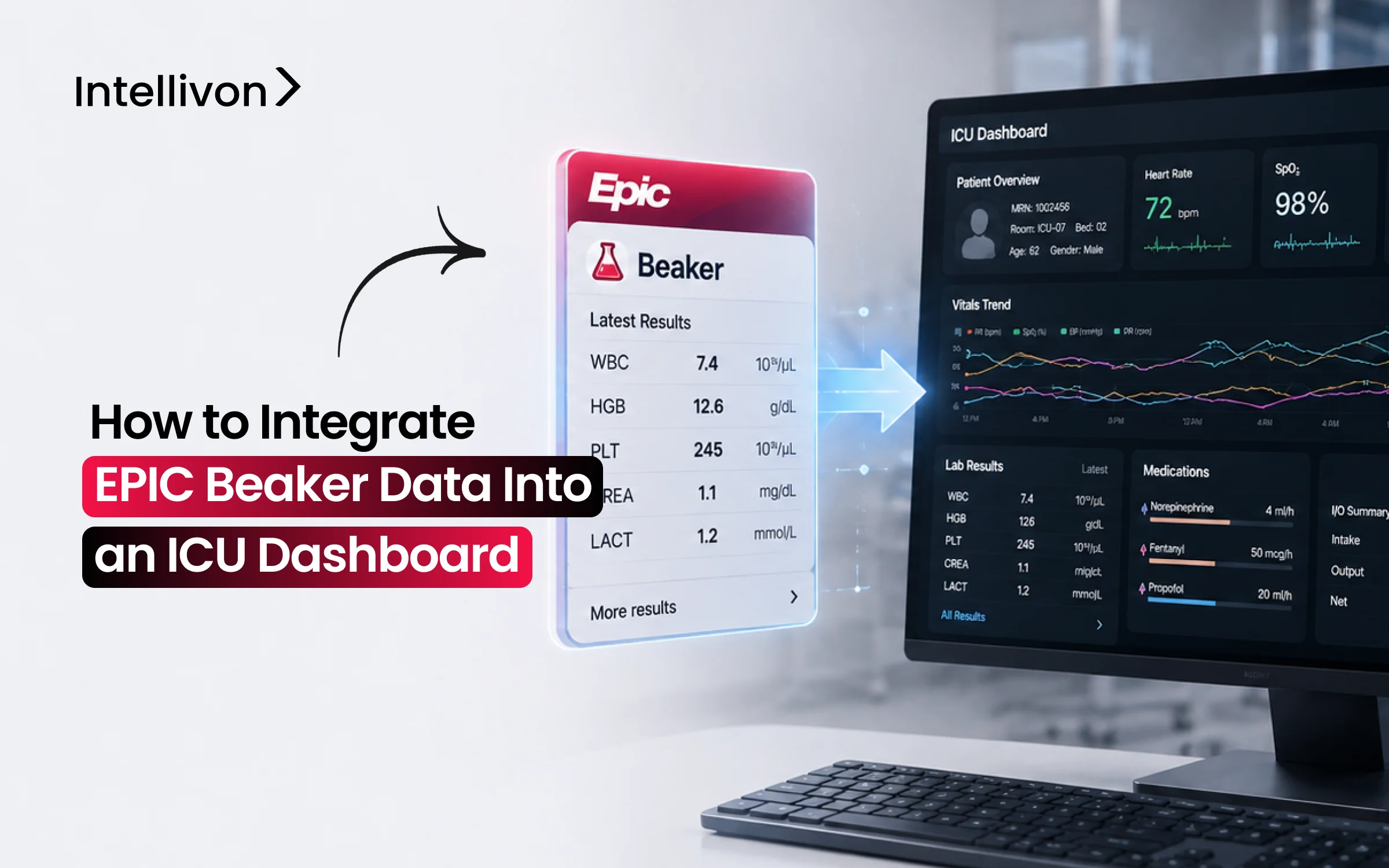 How to Integrate EPIC Beaker Data Into an ICU Dashboard